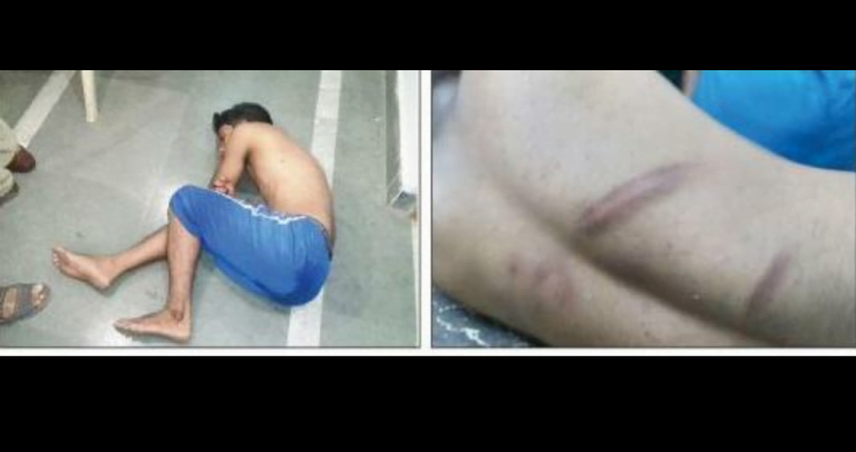 Police Thrash Youth In Bargarh, Irate Locals Gherao PS