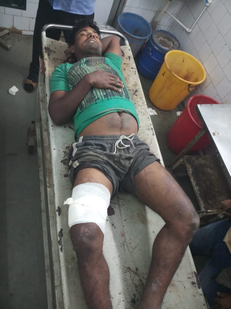 Criminal Injured In Police Encounter In Talcher