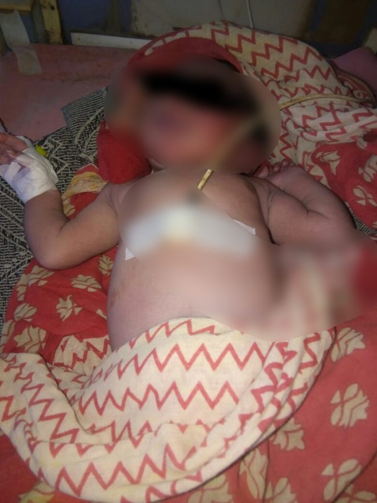 Newborn Boy Rescued From Bhubaneswar Roadside