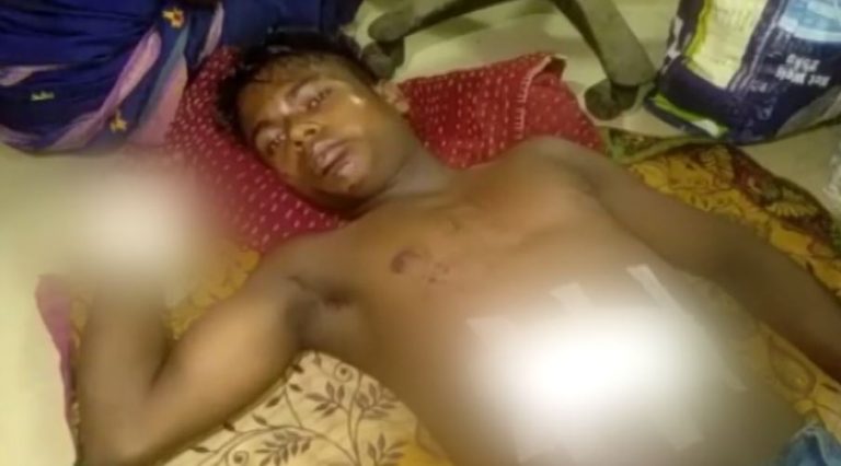 Cellphone Blast Injures Boy In Nabarangpur
