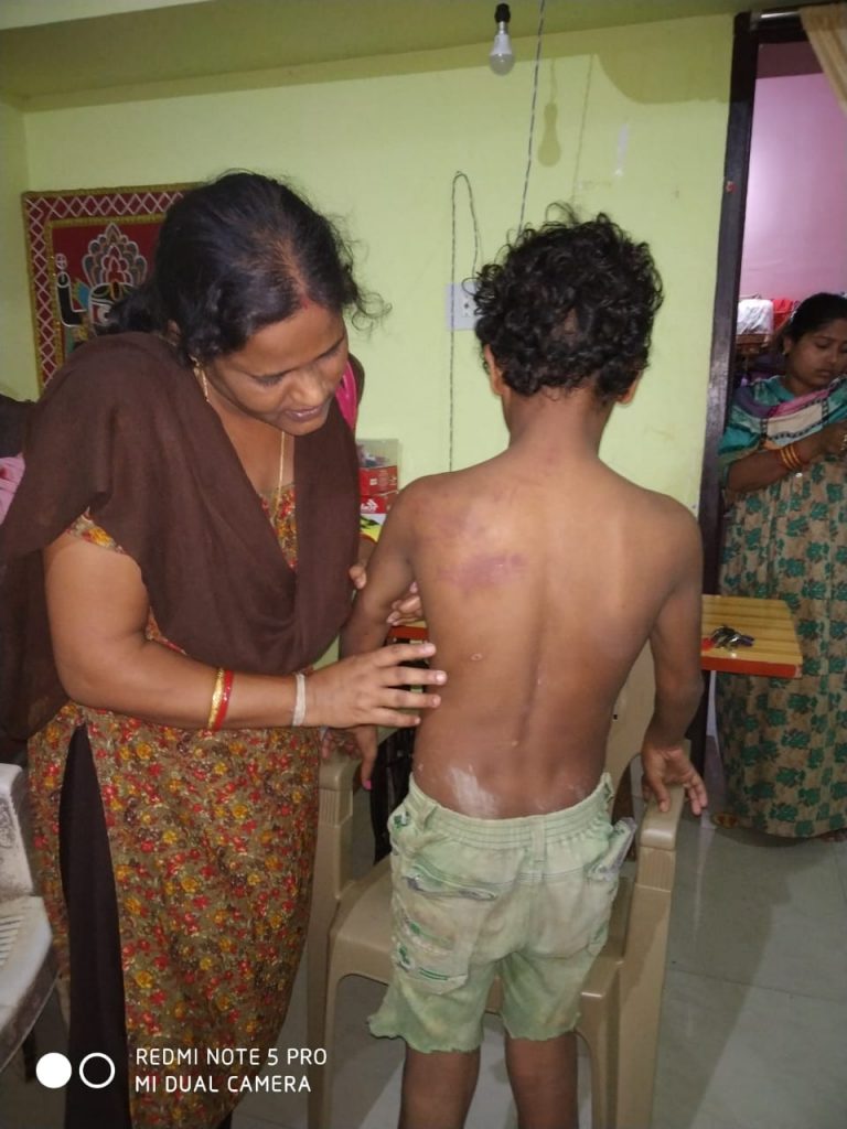 Child Labourer Rescued From ‘Hell’ Factory In Bhubaneswar