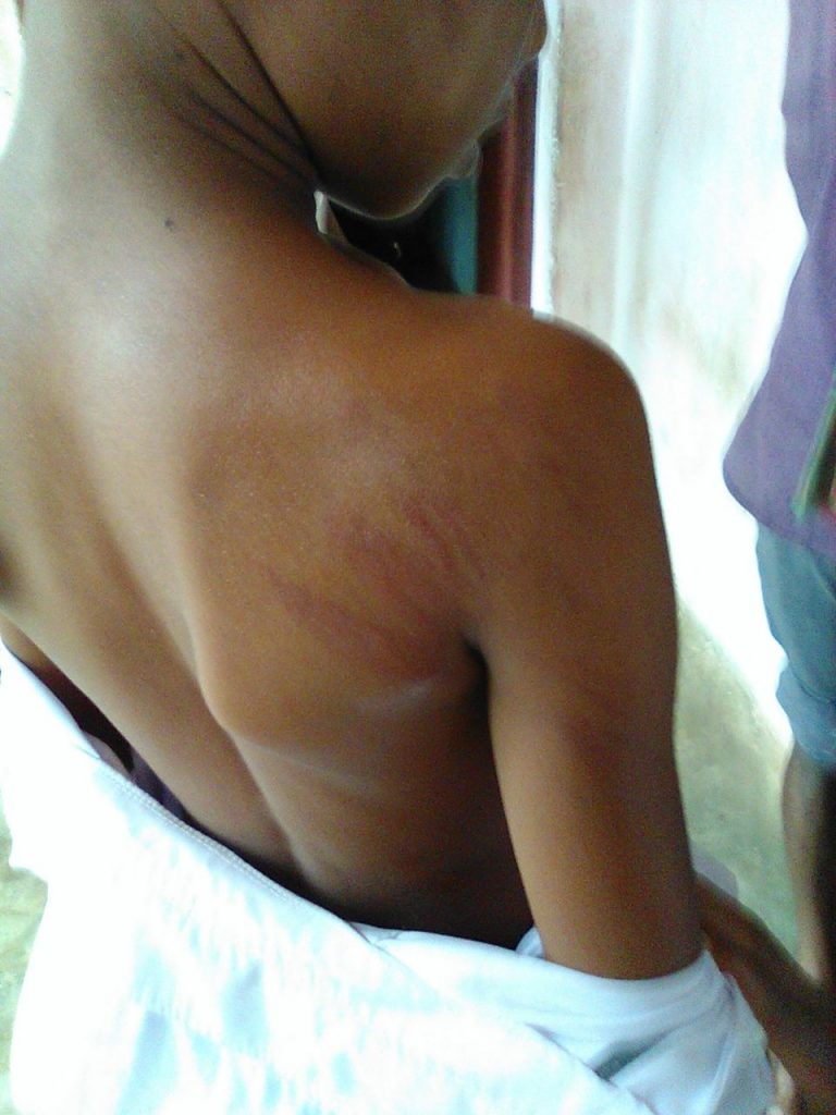 Lady Teacher Beats Up 7 Students For Wrong Answer In Nabarangpur