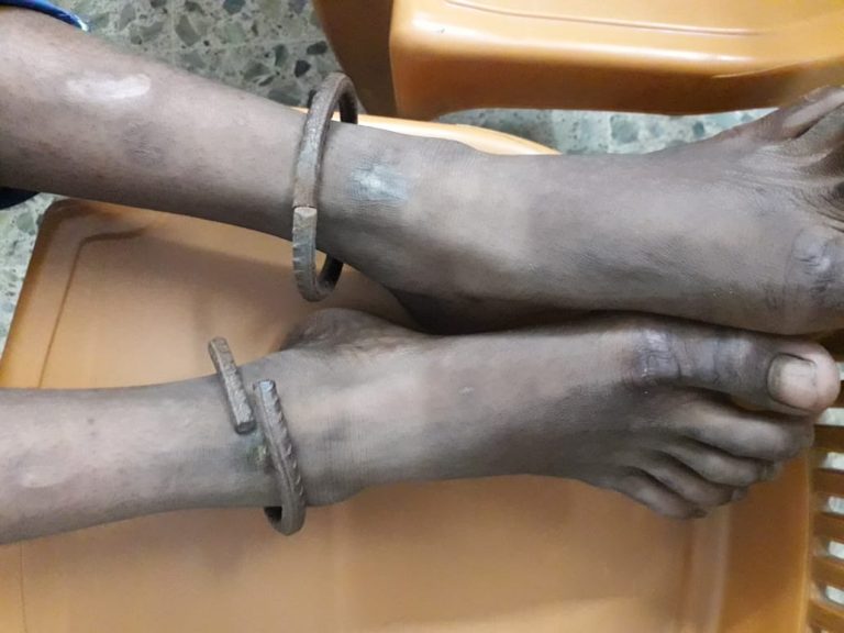 ‘Chained’ Minor Boy Rescued From Bhubaneswar Railway Station