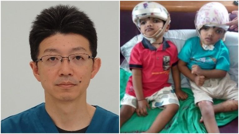 Know The Japanese Neurosurgeon Behind Successful Separation Surgery Of Jaga-Kalia