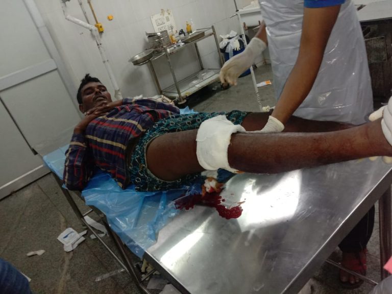 Dacoit Injured In Cuttack Police Encounter