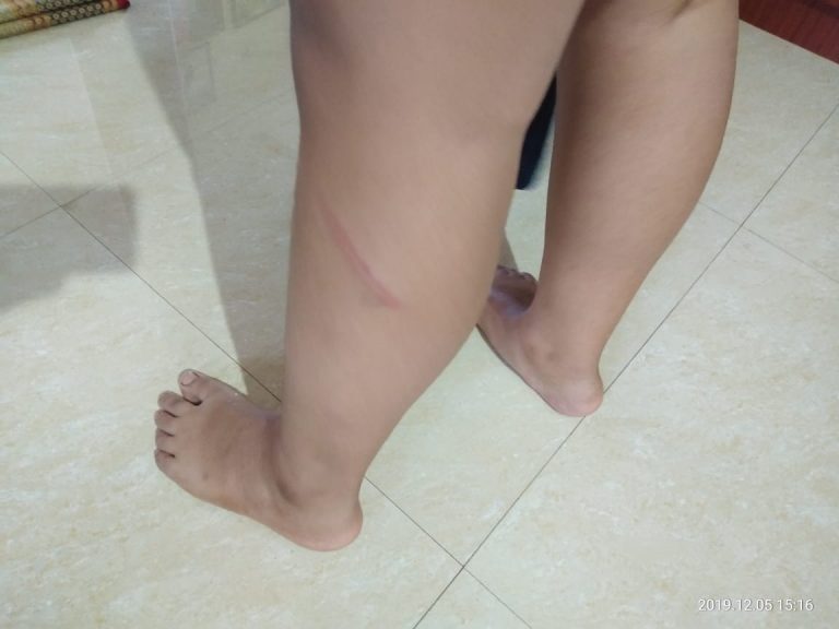 School Teacher Thrashes Minor Boy In Odisha Capital