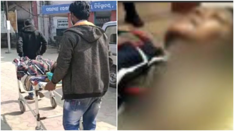 Man Sets Daughter On Fire In Odisha; Uncle Claims Property Dispute