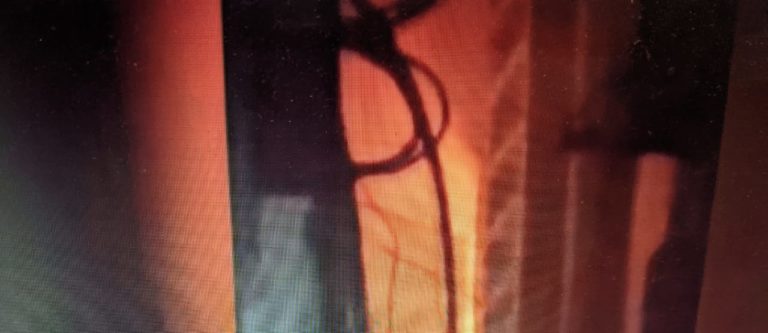 Fire Erupts In Odisha Gramya Bank Office In Cuttack