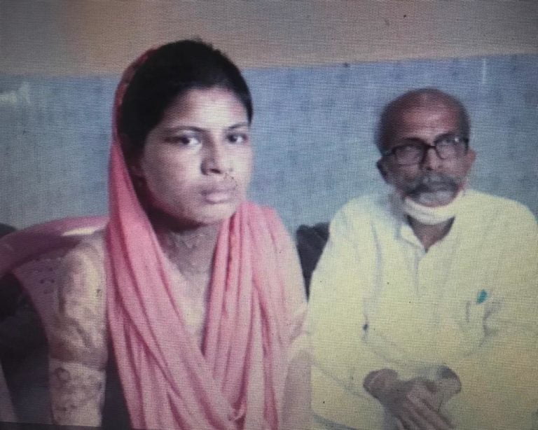 Man Sets Wife On Fire In Odisha, Union Minister Rushes To Victim’s Aid