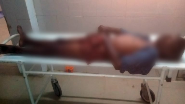 Goatherd In Odisha’s Keonjhar Dist Dies from Bee Sting