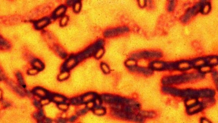 Anthrax: One Dead, Five Affected In Odisha’s Koraput