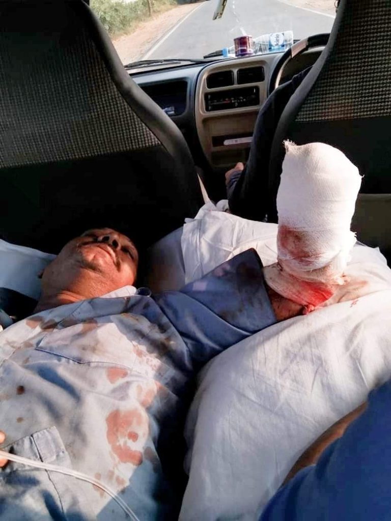 Worker Loses Hand In Conveyor Belt Of Paper Mill In Odisha’s Rayagada