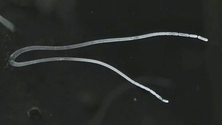 Largest Bacteria Ever, Visible With Naked Eyes Discovered By Scientists