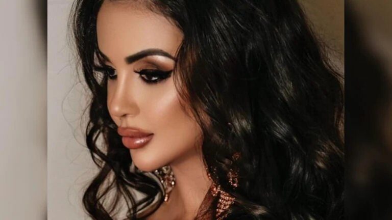 This Model Spent Rs 4 Crore To Look Like Kim Kardashian, Then Rs 95 Lakh To Look Like Herself Again