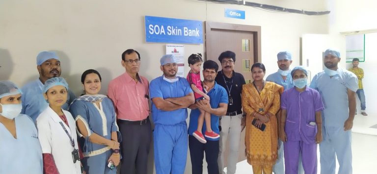 SUM treatment child with burn injury