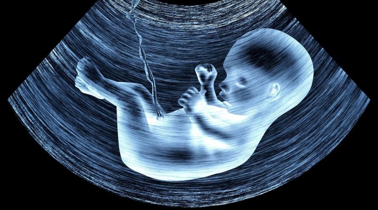 sex determination test