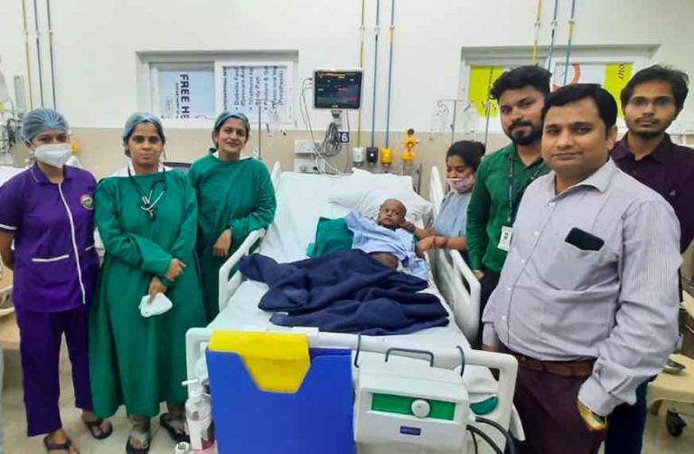 SUM-Bhubaneswar Surgeons Remove 7.5Kg Tumour From Toddler’s Abdomen