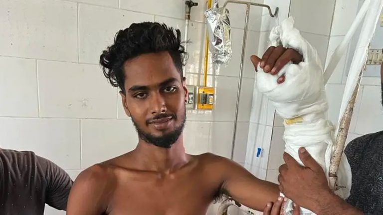 SCBMCH Doctors Replant Chopped Hand Of 22-Yr-Old Youth From Odisha’s Balasore