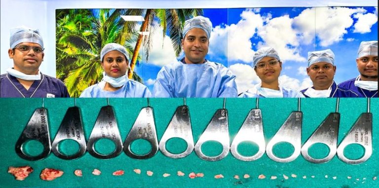 SUMUM procedure 27 stones removed