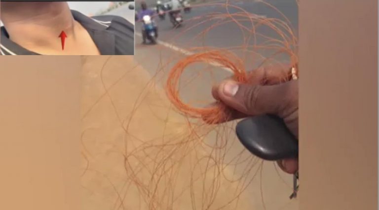 2 Injured By Banned Manja Near Cuttack As Odisha Celebrates Makar Sankranti With Kites