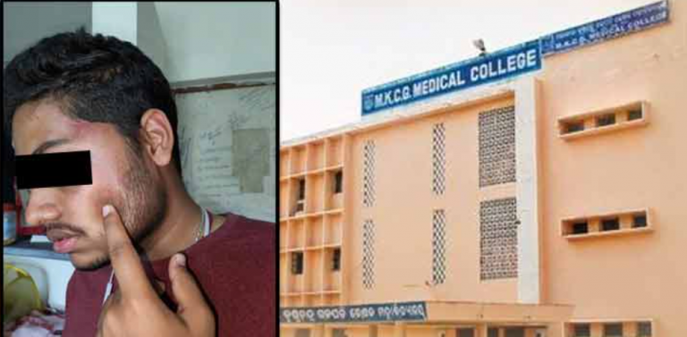 MBBS Student In Odisha’s Berhampur Alleges Ragging, Physical Assault By Seniors; Probe Launched