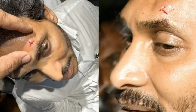 Andhra CM Jagan Reddy Injured In Stone Pelting During Vijayawada Road Show