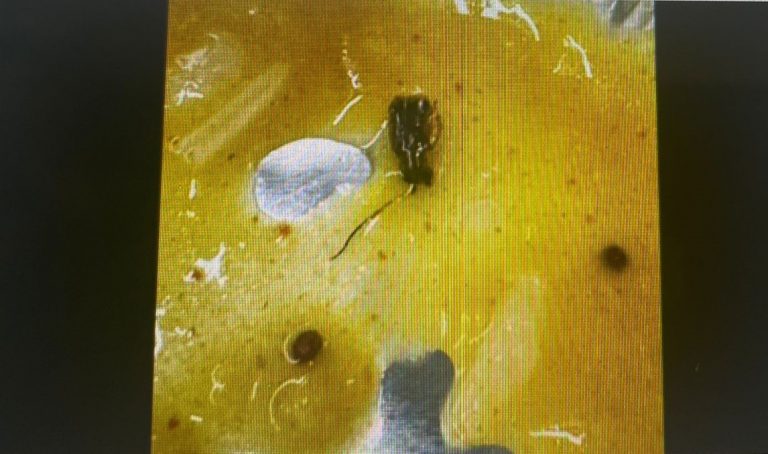 [Watch] Live Cockroach Found In Meal Served On Vande Bharat Express Train