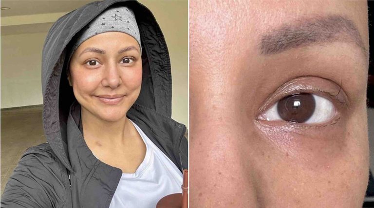 ‘My Motivation’: Hina Khan Shares Picture Of Her ‘Last Standing Eyelash’