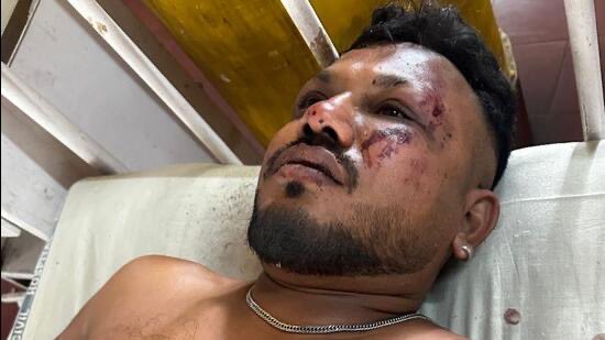 Ahmedabad crash survivor