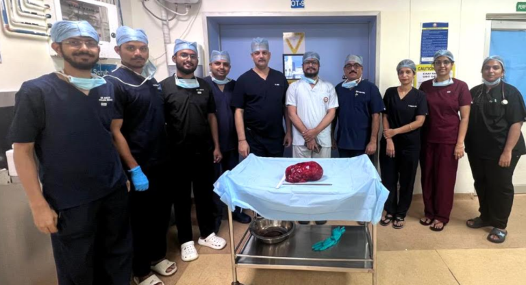 Largest Kidney Tumour In Odisha Removed By SUM Doctors