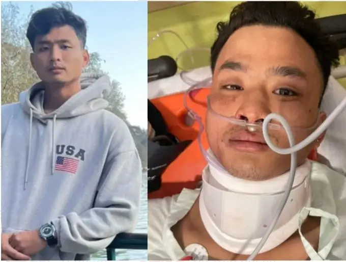 Tripura Student’s Death Sparks Dispute Over Racial Abuse Allegations; Police Say No Proof So Far