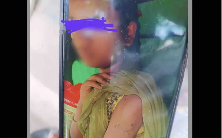 ‘Tortured’ Minor Domestic Help Rescued In Bhubaneswar; Employer Detained