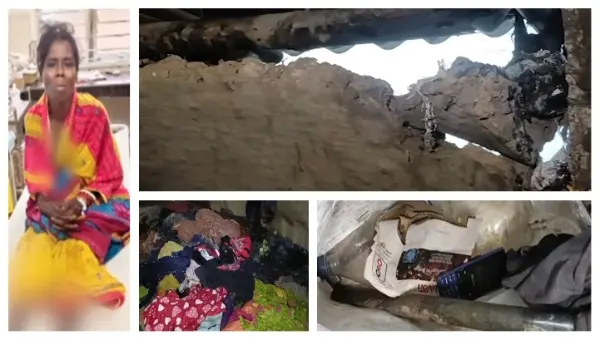 Odisha Couple Set On Fire While Asleep Over ‘Son’s Elopement’, Wife Suffers 70% Burns
