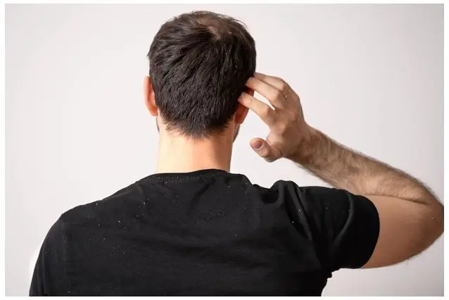 How to Build an Effective Hair Regrowth Routine