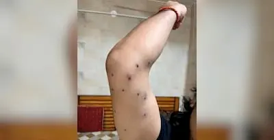 CRPF Identifies RAF Personnel Who Fired Pellets At Protesters In Delhi; Report In A Week