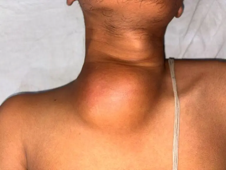 KIMS complex surgery