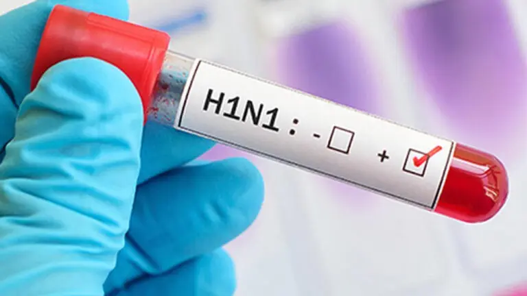 Swine flu or H1N1 spike