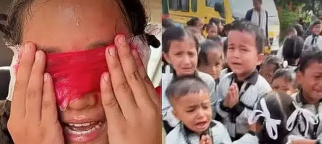 Uttarakhand School Under Probe After ‘Eye Removal’ Act To Curb Mobile Phone Use Leaves Kids In Tears