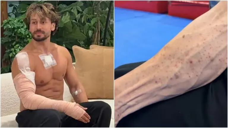 Tiger Shroff’s Team Reveals Injuries After Firing, Shares Video Showing Burn Marks